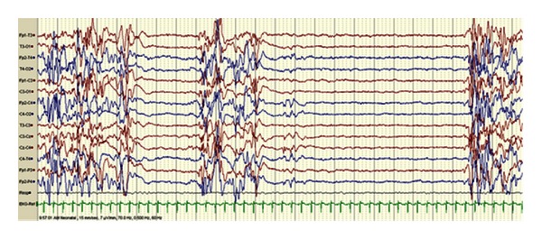 Figure 5