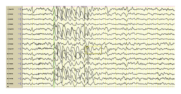 Figure 4