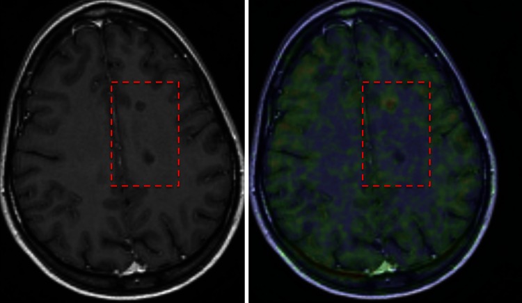 Fig. 1