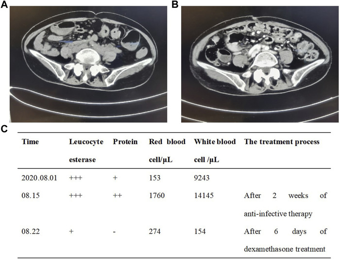 FIGURE 3