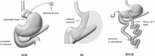 Fig. 1