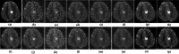 Fig. 11