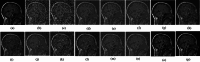 Fig. 12