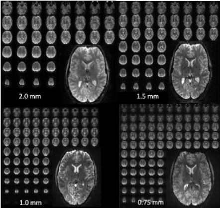 Fig. (1)