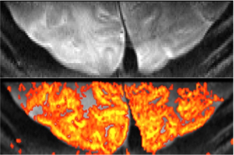 Fig. (5)