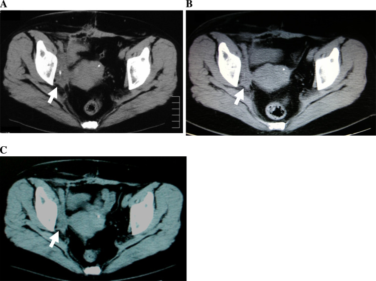 Fig. 3