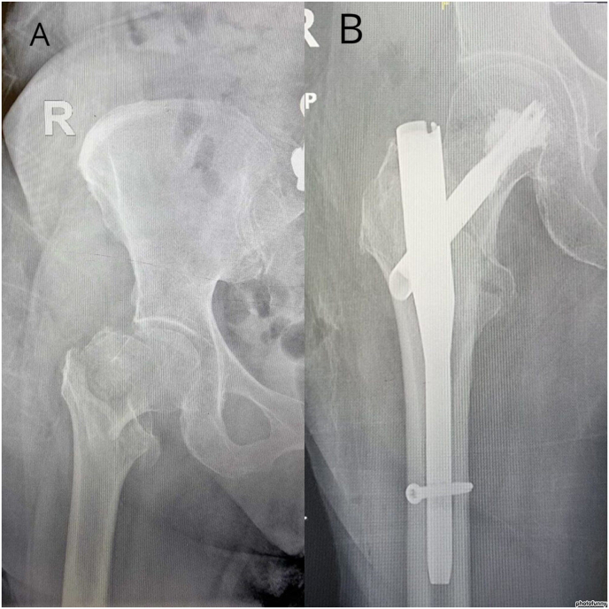 Fig. 2