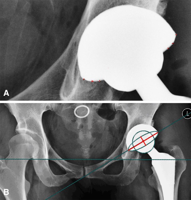 Fig. 1A–B