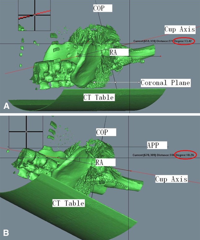 Fig. 4A–B