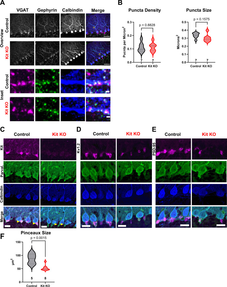 Figure 2—figure supplement 4.