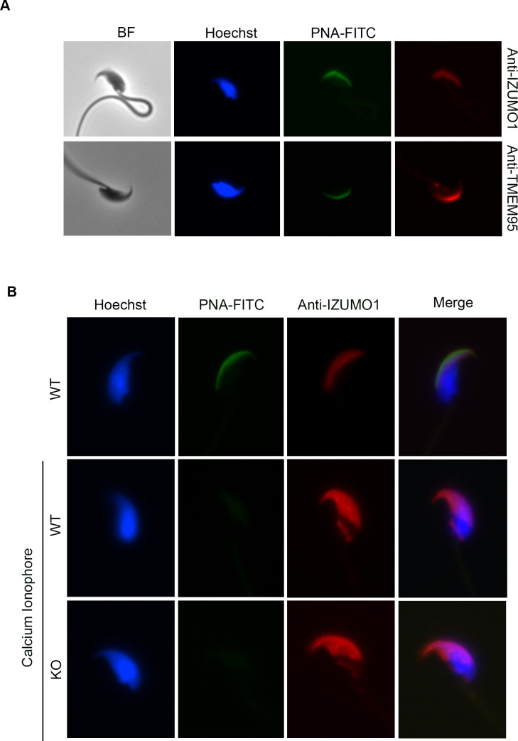 Figure 1—figure supplement 3.