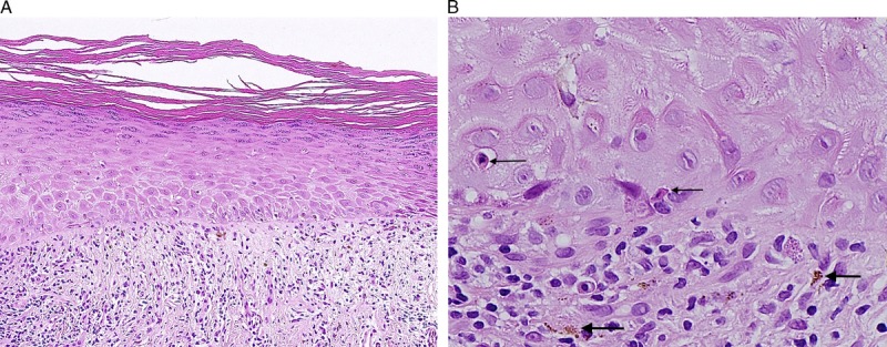 FIGURE 4