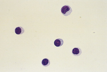 FIGURE 14-29