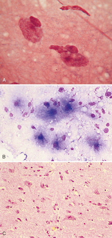 FIGURE 14-38