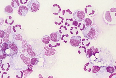 FIGURE 14-22