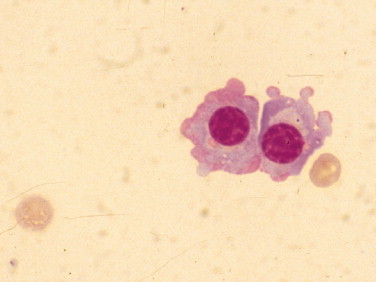 FIGURE 14-15