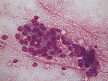 FIGURE 14-40