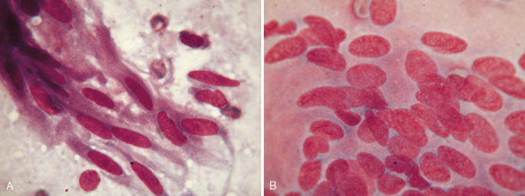 FIGURE 14-47