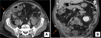 FIG. 1.