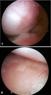 Fig. 2A–B