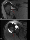 Fig. 1A–B