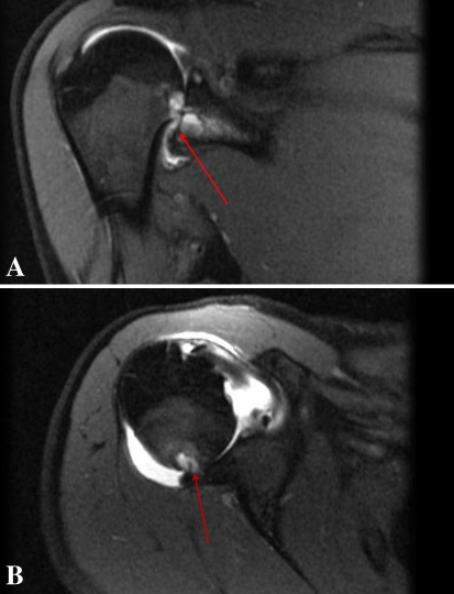 Fig. 1A–B