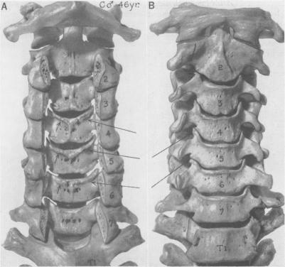 Fig. 11.