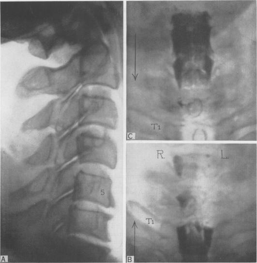 Fig. 2 (Case 2).