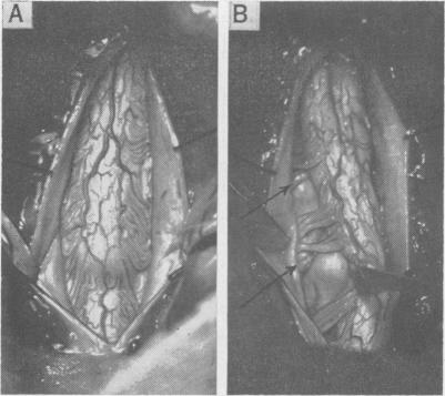 Fig. 10.