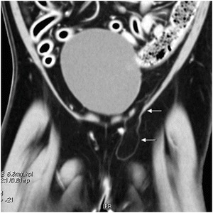 Fig. 31