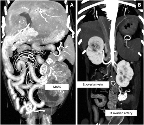 Fig. 29