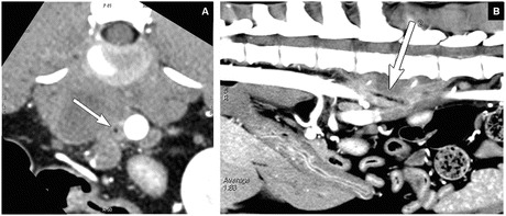 Fig. 14