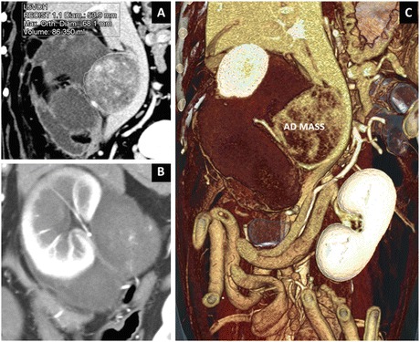 Fig. 20