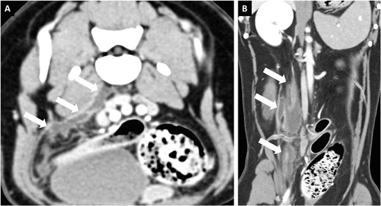 Fig. 13