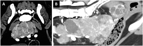 Fig. 18