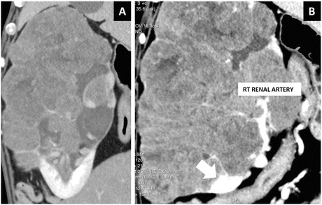 Fig. 28