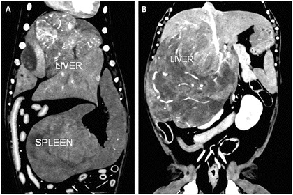 Fig. 23