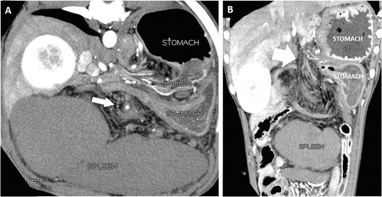 Fig. 33