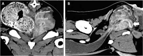 Fig. 34
