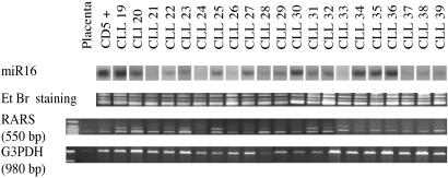 Fig 3.