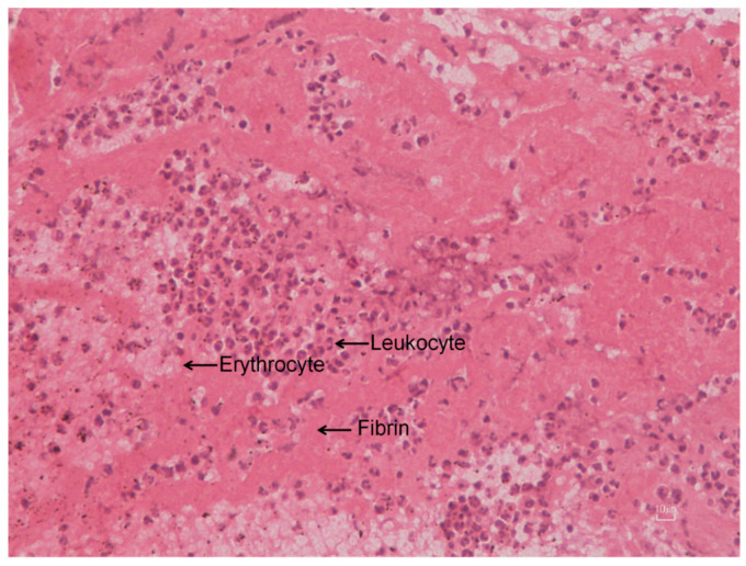 Figure 11