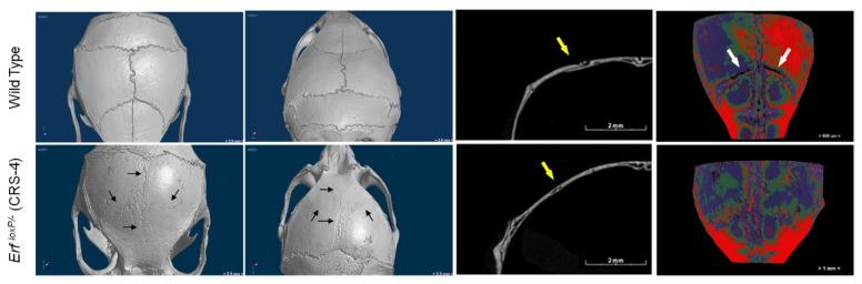 Figure 14