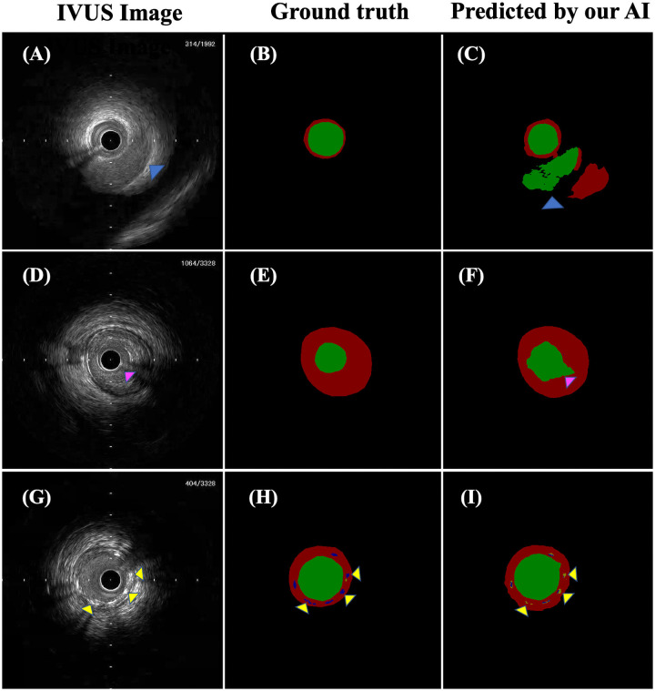 Fig 6