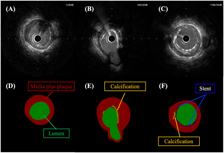 Fig 1