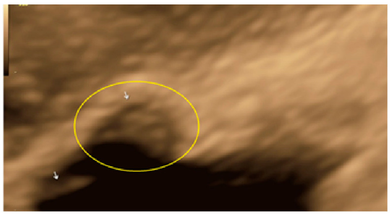 Figure 30