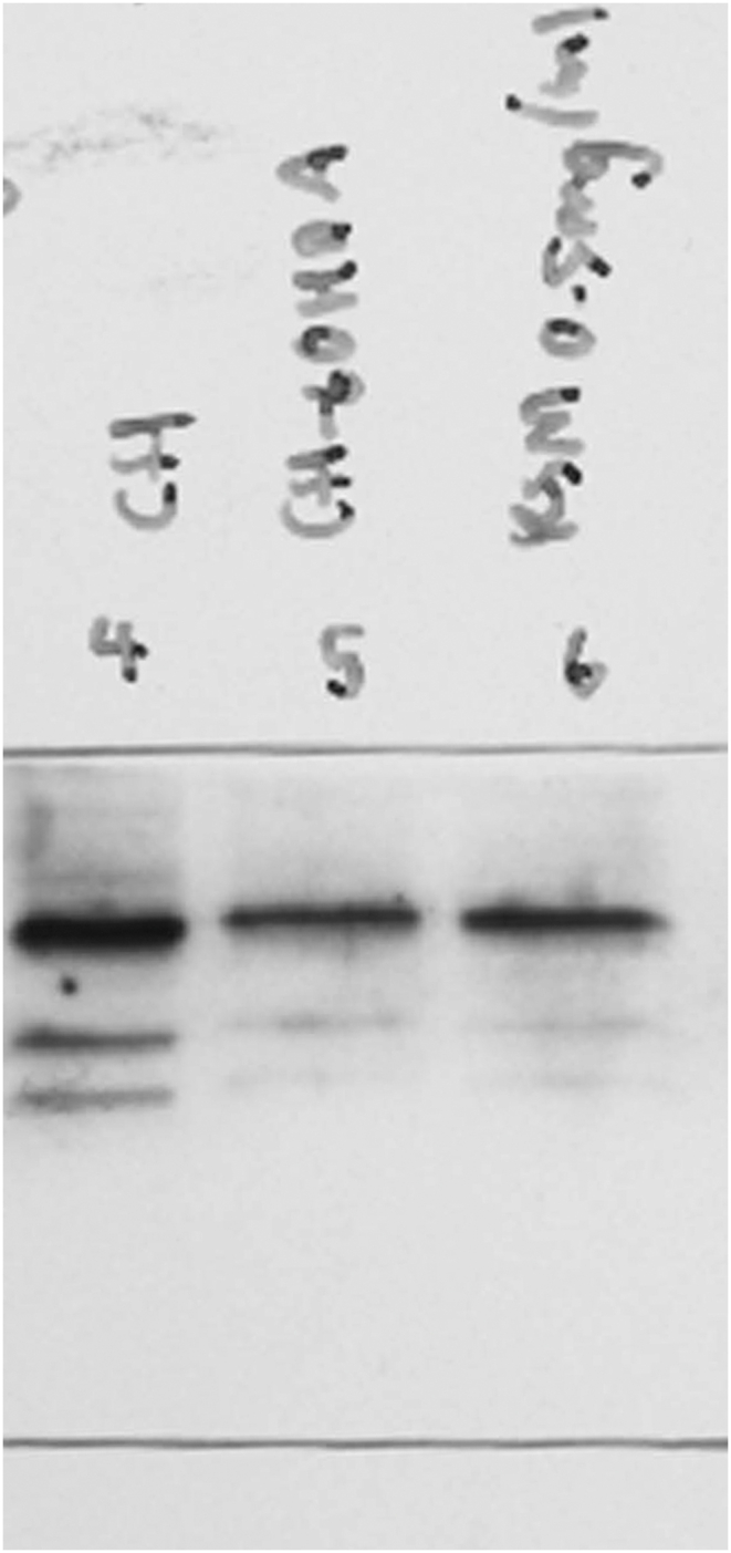 Suppl 6E full blot PRDX-1