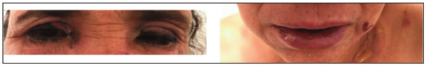Fig. 4