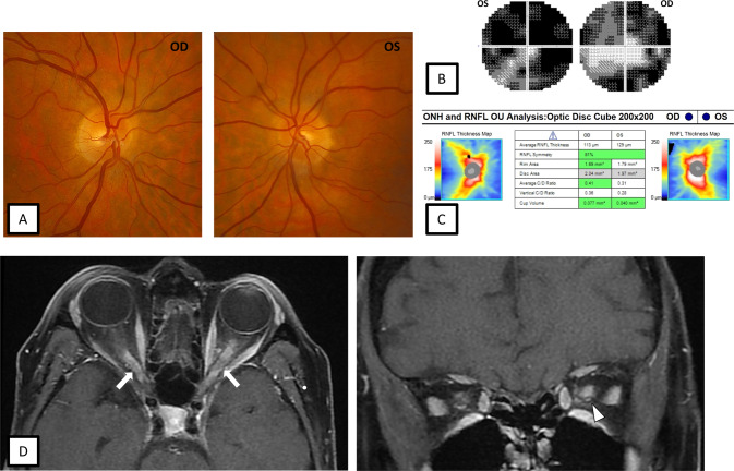 Fig. 2