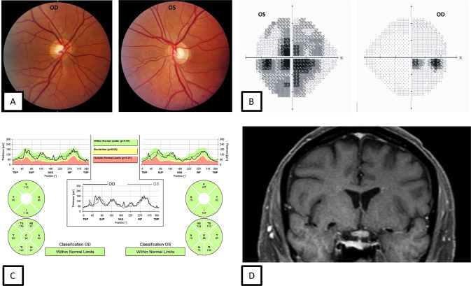 Fig. 1