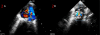 Figure 2